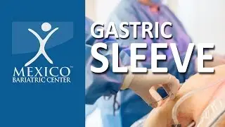 How Gastric Sleeve Works | Animation