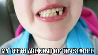 MY TEETH ARE KIND OF UNSTABLE // 061515 // SCOTT NEUMYER