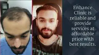 Best Hair Transplant in India | Enhance Clinic | Top 10 Clinics of Hair Transplant