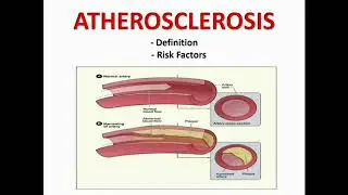 Atherosclerosis | Explanation in Hindi | Definition & Risk Factors
