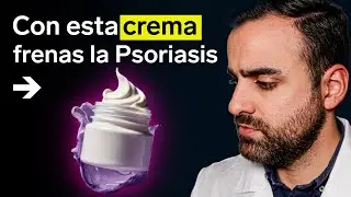 NO Todas las Cremas valen para FRENAR la Psoriasis