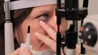 Slit Lamp Techniques   Lissamine Green
