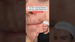 BEST MOISTURIZERS FOR ACNE SKIN!🤩 (follow for more!💗) #acne #oilyskin #skincare #skin #beauty