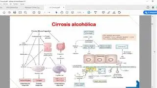 FISIOPATOLOGÍA - Semana 14 - Úlcera Péptica y Cáncer