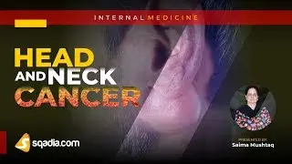 Ear Nose Throat Lecture: Head and Neck Cancer (sqadia.com - Medical V-Learning&trade;)
