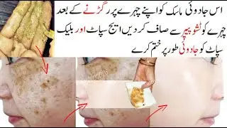 Magical Cream | it removes pigmentation, dark spots,  and age spots and treats melasma
