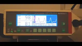 Novametrix Display contrast and screen type