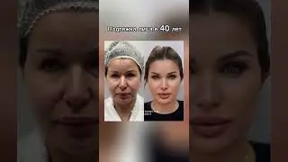 Before & After: Real Results, Natural Beauty Enhanced
