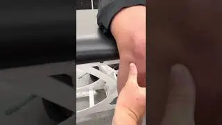 Palpation of the knee bony landmarks