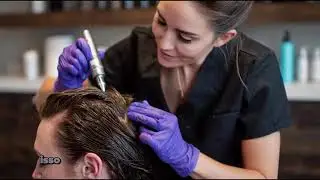 MICROAGULHAMENTO CAPILAR, SOBRANCELHA E BARBA