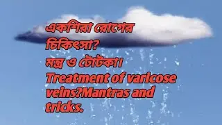 একশিরা রোগের চিকিৎসা? মন্টু ও টোটকা। How to Treatment of varicose veins?Mantras and tricks. 