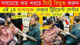 ব্যাথা মুক্ত ট্যাটু রিমুভ করুন😱TATTOO REMOVE COST IN BANGLADESH |TATTOO REMOVAL & LASER TREATMENT BD