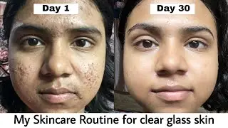 My Skincare Routine for Glass Skin | 30 days clear skin challenge | Acne Treatment | #skincare