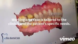 What is a Full-Service Dental Lab?