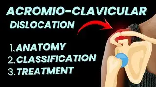 Acromioclavicular Joint Dislocation: Anatomy, Classification, Treatment Explained