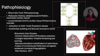Case 10 &nbsp;Rheumatic Fever and Rheumatic Heart Disease