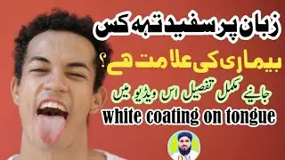 White coating on tongue in Urdu/Hindi by Dr Muhammad MUKHTAR Qadri #health #food #subscribe