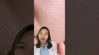 TIPS MERAWAT PORI-PORI BESAR! #skintips #skincaretips #aestheticdoctor #skincare #poriporibesar