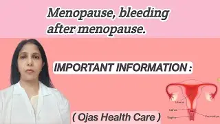MENOPAUSE: FACTS AND POSTMENOPAUSAL BLEEDING @ojashealthcare