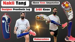 🫵Above Knee Prosthetic Leg | 3D Printed Prosthetic Leg | Ottobock 3R80 | Ossur Liner| #3r80 #ossur