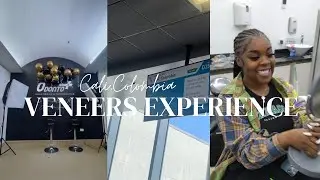 VENEER EXPERIENCE (GETTING MY TEETH DONE IN CALI, COLOMBIA)