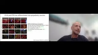 2022 Virtual Program: Dr. Gad Vatine - iPSC Models in CCHS