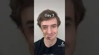 Timelapse of Plastic Surgery Recovery!