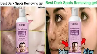 How to remove a dark spot in 7 days? Dark Spot Remover Gel Review 🔥 @Meesho  