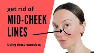 Mid-cheek lines. Face Yoga exercises. Reasons & solution to reduce and prevent mid-cheek lines.