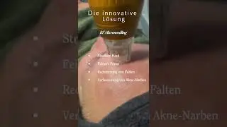 Strahlendere Haut mit RF Microneedling - Deine Beauty-Investition f&uuml;r sichtbare Ergebnisse!