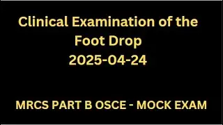 Clinical Examination of the Foot Drop