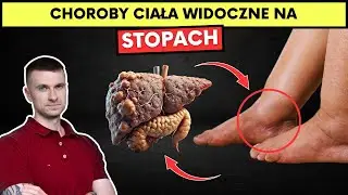 8 oznak ukrytych chor&oacute;b widocznych na Twoich stopach. Skutecznie je wylecz.