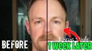 The Only Steps you need for SUPER STRONG skin - mens rene cell #renecell #menskincare