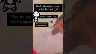 normal chest X -ray 📌📝 follow me🙏#viralvideo #lifeisbutadream #medical #nothingimposibleinthisworld