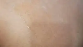 Im injection