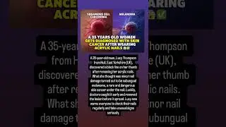 &ldquo;Beauty vs Health: Can Acrylic Nails Cause Cancer? 🧬&rdquo; for more info ​⁠ subscribe @Globalnow-007