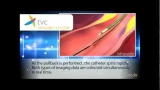 How the TVC Imaging System Works