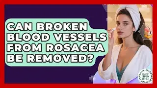 Can Broken Blood Vessels From Rosacea Be Removed? - Healthy Skin Brief