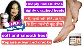 Say goodbye to cracked feet | Ab Fati Adiyo ko kahiye Alvida | Review by Sia Khan