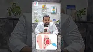 Why Diabetics Should Never Walk Barefoot at Home | Foot Care Tips by Dr. Ambuj