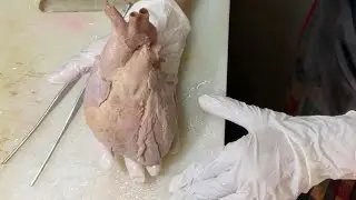 Вскрытие сердца. Часть 2 &mdash; Методы определения притока и оттока крови.