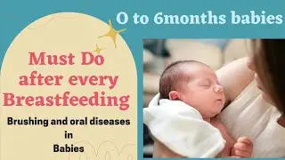0 to 6 months Baby Mouth Cleaning Oral care, rashes, white patch in mouth