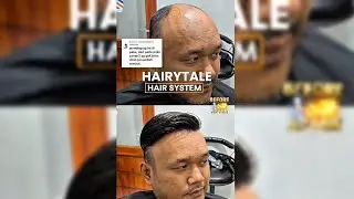 GAK PERLU OBAT! Toupee 0,03mm: Botak hilang seketika TANPA Risiko Obat-obatan - HAIRYTALE