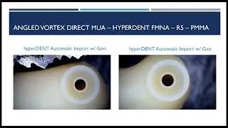 Vortex Screw Hyperdent VHF