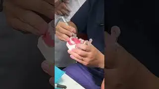 M&agrave;i Ổ Tựa, tựa mặt nhăn Bonwill (1) - PHỤC H&Igrave;NH I (TLBP KHUNG BỘ)
