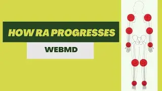 How RA Progresses | 2D Medical Animation | Pixeldust Studios