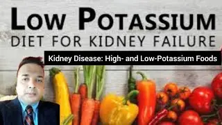 Kidney Disease: High- and Low-Potassium Foods | किडनी पेशेंट के लिए कम Potassium वाली Diet | #health