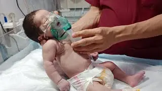 Pray for Baby 🤲 | Severe Bronchitis Treatment with Nebulization 👶 #nebulization #cute #pray #baby 