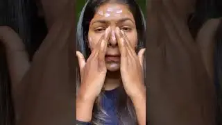 Lacto calamine lotion Review😊 #shorts #viral #shortsvideo ￼