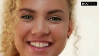 Microneedling Before and After in Flower Mound/Dallas, TX | Skin Glow Journey